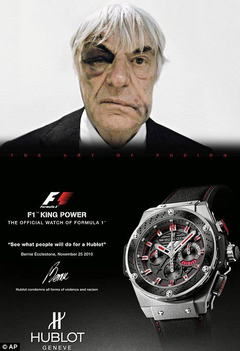 see what people will do for a hublot|Battered Bernie Ecclestone Turned a Freakish Mugging Incident .